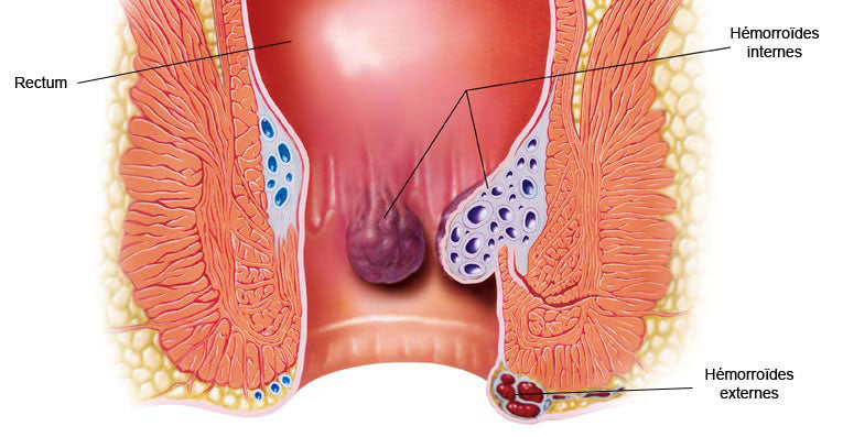 Anatomie du réseau hémorroïdaire